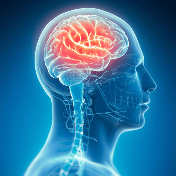 Preciso de Cirurgia para Malformação de Chiari